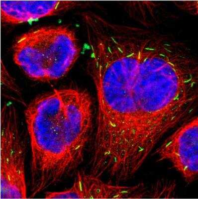 Immunocytochemistry/Immunofluorescence: MST2/STK3 Antibody [NBP1-89586] - Staining of human cell line U-2 OS shows localization to rods & rings. Antibody staining is shown in green.