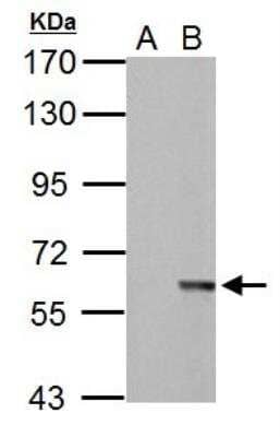 Western Blot: MST2/STK3 Antibody [NBP1-32313] - Sample (30 ug of whole cell lysate) A: Non-transfected 293T lysates B: STK3 transfected 293T lysates 7. 5% SDS PAGE; antibody diluted at 1:5000.