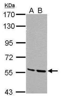 Western Blot: MST2/STK3 Antibody [NBP1-32313] - Sample (30 ug of whole cell lysate) A: NIH-3T3 B: JC 7.5% SDS PAGE diluted at 1:5000 