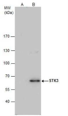 Western Blot: MST2/STK3 Antibody [NBP2-19421] - STK3 antibody immunoprecipitates STK3 protein in IP experiments. IP samples: HeLa whole cell extract A. Control with 4 ug of preimmune Rabbit IgG. B. Immunoprecipitation of STK3 protein by 4 ug STK3 antibody 7.5 % SDS-PAGE.The immunoprecipitated STK3 protein was detected by STK3 antibody diluted at 1:500. Anti-rabbit IgG was used as a secondary reagent