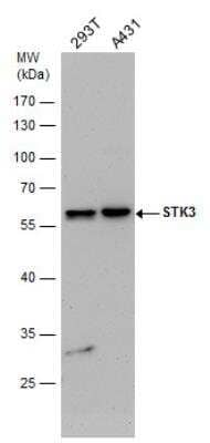 Western Blot: MST2/STK3 Antibody [NBP2-19421] - STK3 antibody detects STK3 protein by western blot analysis. Various whole cell extracts (30 ug) were separated by 10% SDS-PAGE, and the membrane was blotted with STK3 antibody diluted by 1:1000.