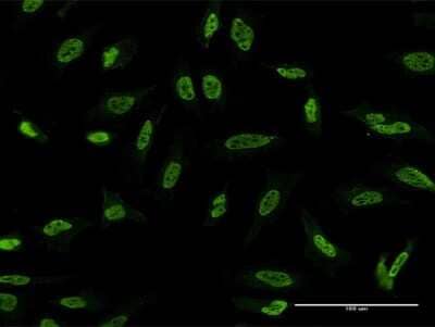 Immunocytochemistry/Immunofluorescence: MST3 Antibody (3F2) [H00008428-M04] - Analysis of monoclonal antibody to STK24 on HeLa cell. Antibody concentration 10 ug/ml