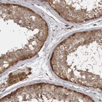 Immunohistochemistry-Paraffin: MST3 Antibody [NBP1-87834] - Staining of human testis shows moderate cytoplasmic positivity in cells in seminiferous ducts.