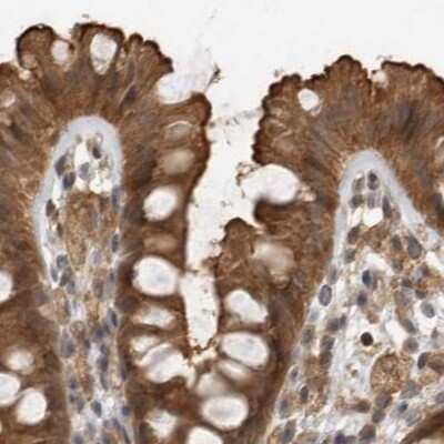 Immunohistochemistry-Paraffin: MST3 Antibody [NBP1-87834] - Staining of human colon.