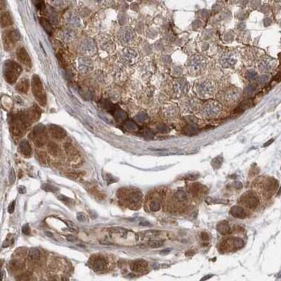 Immunohistochemistry-Paraffin: MST3 Antibody [NBP1-87834] - Staining of human testis.