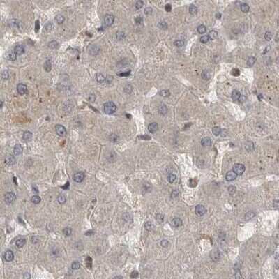 Immunohistochemistry-Paraffin: MST3 Antibody [NBP1-87834] - Staining of human liver.