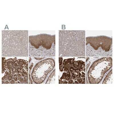 <b>Independent Antibodies Validation. </b>Immunohistochemistry-Paraffin: MST3 Antibody [NBP1-87834] - Staining of human liver, skin, small intestine and testis using Anti-STK24 antibody NBP1-87834 (A) shows similar protein distribution across tissues to independent antibody NBP1-87833 (B).