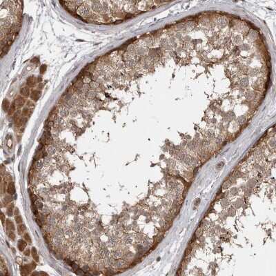 Immunohistochemistry-Paraffin: MST3 Antibody [NBP1-87834] - Staining of human testis shows moderate to strong cytoplasmic positivity in cells in seminiferous ducts.