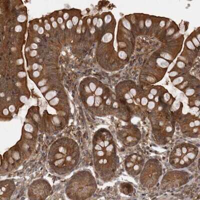 Immunohistochemistry-Paraffin: MST3 Antibody [NBP1-87834] - Staining of human small intestine shows strong cytoplasmic positivity in glandular cells.