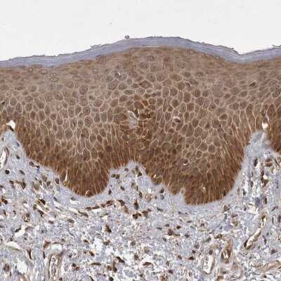 <b>Independent Antibodies Validation. </b>Immunohistochemistry-Paraffin: MST3 Antibody [NBP1-87834] - Staining of human skin shows moderate cytoplasmic positivity in squamous epithelial cells.