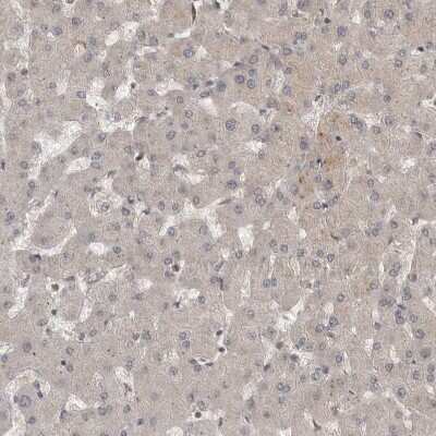 Immunohistochemistry-Paraffin: MST3 Antibody [NBP1-87834] - Staining of human liver shows very weak positivity in hepatocytes as expected.