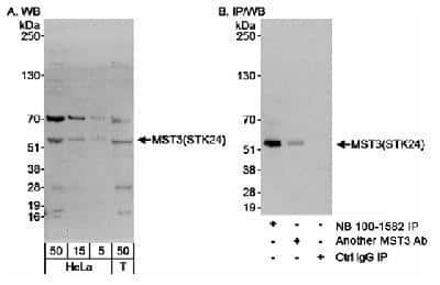 Western Blot: MST3 Antibody [NB100-1582] - Detection of Human MST3(STK24) on HeLa whole cell lysate.