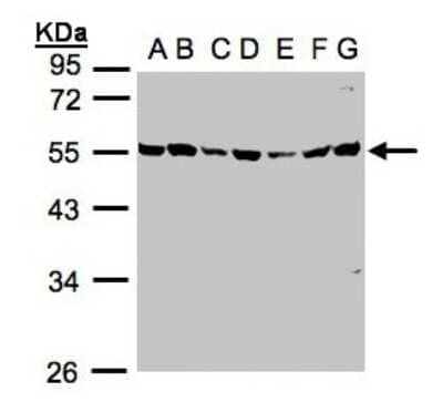 Western Blot: MST3 Antibody [NBP1-31575] - Sample(30ug whole cell lysate)A: 293T B: A431 C: H1299 D: HeLa S3 E: Hep G2 F: MOLT4 G: Raji 10% SDS PAGE, antibody diluted at 1:1000.