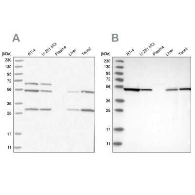 Western Blot: MST3 Antibody [NBP1-87834] - Analysis using Anti-STK24 antibody NBP1-87834 (A) shows similar pattern to independent antibody NBP1-87833 (B).