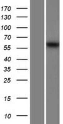 Western Blot: MSTO1 Overexpression Lysate (Adult Normal) [NBP2-06873] Left-Empty vector transfected control cell lysate (HEK293 cell lysate); Right -Over-expression Lysate for MSTO1.