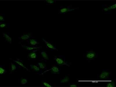 Immunocytochemistry/Immunofluorescence: MSX2 Antibody [H00004488-B01P] - Analysis of purified antibody to MSX2 on HeLa cell. (antibody concentration 10 ug/ml)