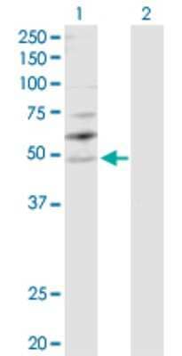 Western Blot: MSY2 Antibody [H00051087-D01P] - Analysis of YBX2 expression in transfected 293T cell line by YBX2 polyclonal antibody.Lane 1: YBX2 transfected lysate(38.60 KDa).Lane 2: Non-transfected lysate.