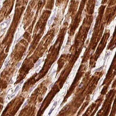 Immunohistochemistry-Paraffin: MT-CO2 Antibody [NBP2-37930] - Staining of human heart muscle.