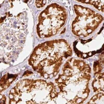 Immunohistochemistry-Paraffin: MT-CO2 Antibody [NBP2-37930] - Staining of human kidney.