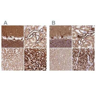 <b>Independent Antibodies Validation. </b>Immunohistochemistry-Paraffin: MT-CO2 Antibody [NBP2-37930] - Staining of human cerebellum, kidney, liver and stomach using Anti-MT-CO2 antibody NBP2-37930 (A) shows similar protein distribution across tissues to independent antibody NBP2-37945 (B).