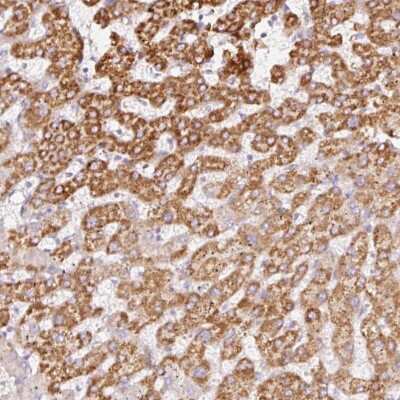 Immunohistochemistry-Paraffin: MT-CO2 Antibody [NBP2-37930] - Staining of human liver shows moderate granular cytoplasmic positivity in hepatocytes.