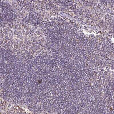 Immunohistochemistry-Paraffin: MT-CO2 Antibody [NBP2-37945] - Staining of human lymph node shows low expression as expected.