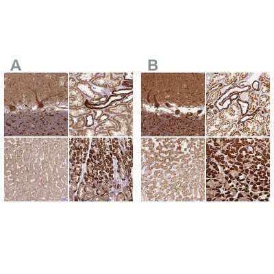 <b>Independent Antibodies Validation. </b>Immunohistochemistry-Paraffin: MT-CO2 Antibody [NBP2-37945] - Staining of human cerebellum, kidney, liver and stomach using Anti-MT-CO2 antibody NBP2-37945 (A) shows similar protein distribution across tissues to independent antibody NBP2-37930 (B).