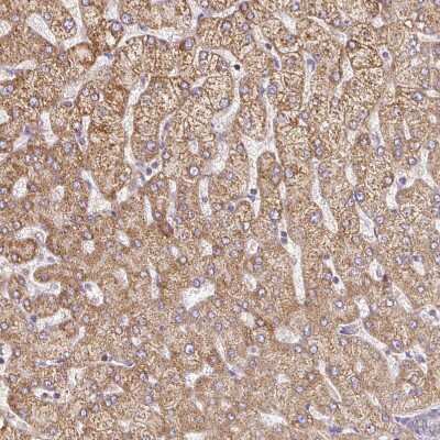 Immunohistochemistry-Paraffin: MT-CO2 Antibody [NBP2-37945] - Staining of human liver shows moderate granular cytoplasmic positivity in hepatocytes.