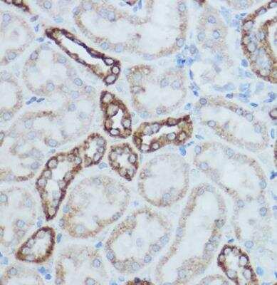 Immunohistochemistry-Paraffin: MT-CO2 Antibody [NBP2-94364] - Mouse kidney using MTCO2 Rabbit pAb at dilution of 1:500 (40x lens).