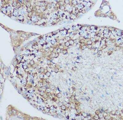 Immunohistochemistry-Paraffin: MT-CO2 Antibody [NBP2-94364] - Rat testis using MTCO2 Rabbit pAb at dilution of 1:500 (40x lens).