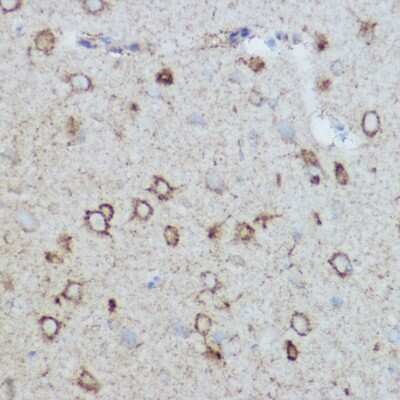 Immunohistochemistry-Paraffin: MT-CO2 Antibody [NBP2-94441] - Immunohistochemistry of paraffin-embedded mouse brain using MT-CO2 Rabbit pAb (NBP2-94441) at dilution of 1:400 (40x lens). Perform high pressure antigen retrieval with 10 mM citrate buffer pH 6.0 before commencing with IHC staining protocol.