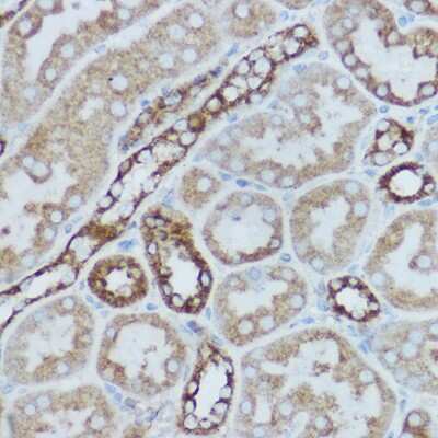 Immunohistochemistry-Paraffin: MT-CO2 Antibody [NBP2-94441] - Immunohistochemistry of paraffin-embedded rat kidney using MT-CO2 Rabbit pAb (NBP2-94441) at dilution of 1:400 (40x lens). Perform high pressure antigen retrieval with 10 mM citrate buffer pH 6.0 before commencing with IHC staining protocol.
