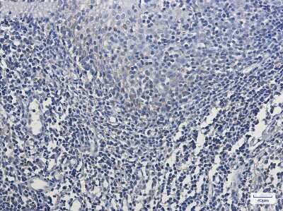 Immunohistochemistry-Paraffin: MT-CO2 Antibody (S05-7E7) [NBP3-14958] - Immunohistochemistry of MT-CO2 in paraffin-embedded Human tonsil using MT-CO2 Rabbit mAb at dilution 1/50