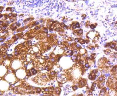 Immunohistochemistry-Paraffin: MT-CO2 Antibody (SC06-88) [NBP2-67617] - Analysis of paraffin-embedded human liver tissue using anti-MTCO2 antibody. Counter stained with hematoxylin.