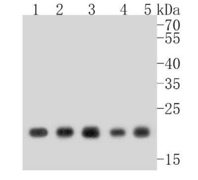 Western Blot: MT-CO2 Antibody (SC06-88) [NBP2-67617] - Analysis of MTCO2 on different lysates. Proteins were transferred to a PVDF membrane and blocked with 5% BSA in PBS for 1 hour at room temperature. The primary antibody (1/500) was used in 5% BSA at room temperature for 2 hours. Goat Anti-Rabbit IgG - HRP Secondary Antibody at 1:5,000 dilution was used for 1 hour at room temperature. Positive control: Lane 1: MCF-7 cell lysateLane 2: THP-1 cell lysate Lane 3: Hela cell lysate Lane 4: human lung tissue lysate Lane 5: human placenta tissue lysate