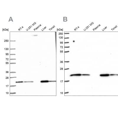 Western Blot: MT-CO2 Antibody [NBP2-37945] - Analysis using Anti-MT-CO2 antibody NBP2-37945 (A) shows similar pattern to independent antibody NBP2-37930 (B).