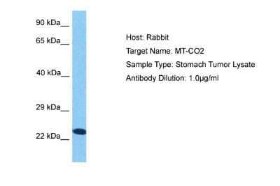 Western Blot: MT-CO2 Antibody [NBP2-87854] - Host: Rabbit. Target Name: MT-CO2. Sample Tissue: Human Stomach Tumor lysates. Antibody Dilution: 1ug/ml