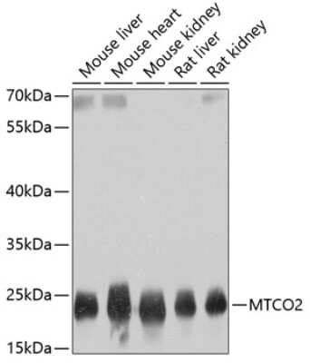 Western Blot: MT-CO2 Antibody [NBP2-94441] - Analysis of extracts of various cell lines, using MT-CO2 at 1:800 dilution.Secondary antibody: HRP Goat Anti-Rabbit IgG (H+L) at 1:10000 dilution.Lysates/proteins: 25ug per lane.Blocking buffer: 3% nonfat dry milk in TBST.Detection: ECL Basic Kit .Exposure time: 1s.