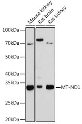 Western Blot: MT-ND1 Antibody (5J5C8) [NBP3-16870] - Western blot analysis of extracts of various cell lines, using MT-ND1 antibody (NBP3-16870) at 1:1000 dilution. Secondary antibody: HRP Goat Anti-Rabbit IgG (H+L) at 1:10000 dilution. Lysates/proteins: 25ug per lane. Blocking buffer: 3% nonfat dry milk in TBST. Detection: ECL Basic Kit. Exposure time: 180s.