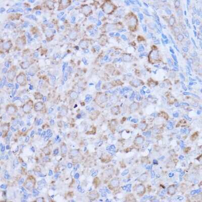 Immunohistochemistry-Paraffin: MT-ND1 Antibody [NBP2-94462] - Rat ovary using MT-ND1 antibody at dilution of 1:100 (40x lens).