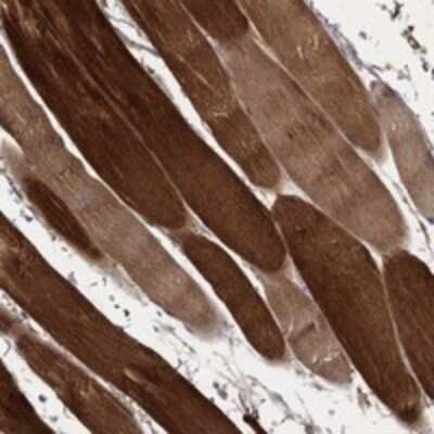 Immunohistochemistry-Paraffin: MT-ND1 Antibody [NBP3-17519] - Staining of human skeletal muscle shows strong cytoplasmic positivity in myocytes.