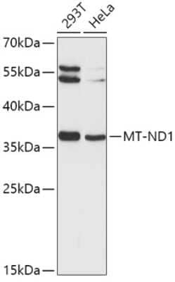 Western Blot: MT-ND1 Antibody [NBP2-94324] - Analysis of extracts of various cell lines, using MT-ND1 at 1:1000 dilution.Secondary antibody: HRP Goat Anti-Rabbit IgG (H+L) at 1:10000 dilution.Lysates/proteins: 25ug per lane.Blocking buffer: 3% nonfat dry milk in TBST.Detection: ECL Basic Kit .Exposure time: 5s.