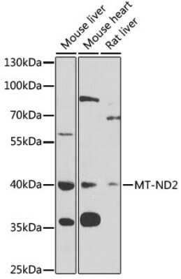 Western Blot: MT-ND2 Antibody [NBP3-05588] - Western blot analysis of extracts of various cell lines, using MT-ND2 antibody (NBP3-05588) at 1:1000 dilution. Secondary antibody: HRP Goat Anti-Rabbit IgG (H+L) at 1:10000 dilution. Lysates/proteins: 25ug per lane. Blocking buffer: 3% nonfat dry milk in TBST. Detection: ECL Basic Kit. Exposure time: 90s.