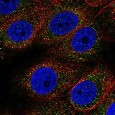 Immunocytochemistry/Immunofluorescence: MT-ND3 Antibody [NBP2-38021] - Immunofluorescent staining of human cell line MCF7 shows localization to cytosol. Antibody staining is shown in green. 