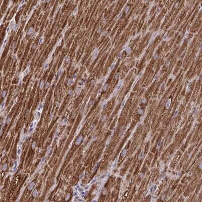 Immunohistochemistry-Paraffin: MT-ND3 Antibody [NBP2-38021] - Staining of human heart muscle shows high expression.