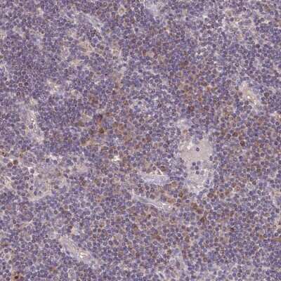 Immunohistochemistry-Paraffin: MT-ND3 Antibody [NBP2-38021] - Staining of human lymph node shows low expression as expected.