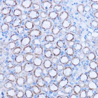 Immunohistochemistry-Paraffin: MT-ND3 Antibody [NBP2-93832] - Mouse kidney using MT-ND3 antibody at dilution of 1:100 (40x lens).Perform microwave antigen retrieval with 10 mM PBS buffer pH 7.2 before commencing with IHC staining protocol.