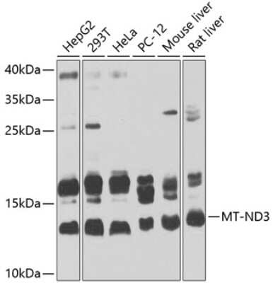 Western Blot: MT-ND3 Antibody [NBP2-93571] - Analysis of extracts of various cell lines, using MT-ND3 at 1:1000 dilution.Secondary antibody: HRP Goat Anti-Rabbit IgG (H+L) at 1:10000 dilution.Lysates/proteins: 25ug per lane.Blocking buffer: 3% nonfat dry milk in TBST.Detection: ECL Basic Kit .Exposure time: 30s.