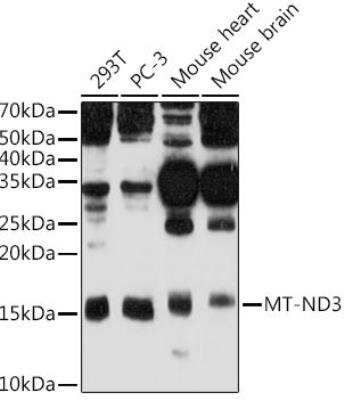 Western Blot: MT-ND3 Antibody [NBP2-93832] - Analysis of extracts of various cell lines, using MT-ND3 antibody at 1:500 dilution.Secondary antibody: HRP Goat Anti-Rabbit IgG (H+L) at 1:10000 dilution.Lysates/proteins: 25ug per lane. Blocking buffer: 3% nonfat dry milk in TBST.Detection: ECL Basic Kit. Exposure time: 90s.