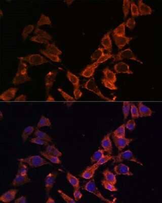 Immunocytochemistry/Immunofluorescence: MT-ND4 Antibody [NBP2-93530] - Analysis of L929 cells using MT-ND4 at dilution of 1:100. Blue: DAPI for nuclear staining.